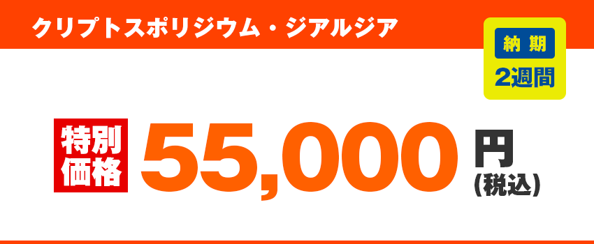 その他、原水の水質検査価格 クリプトスポリジウム・ジアルジア